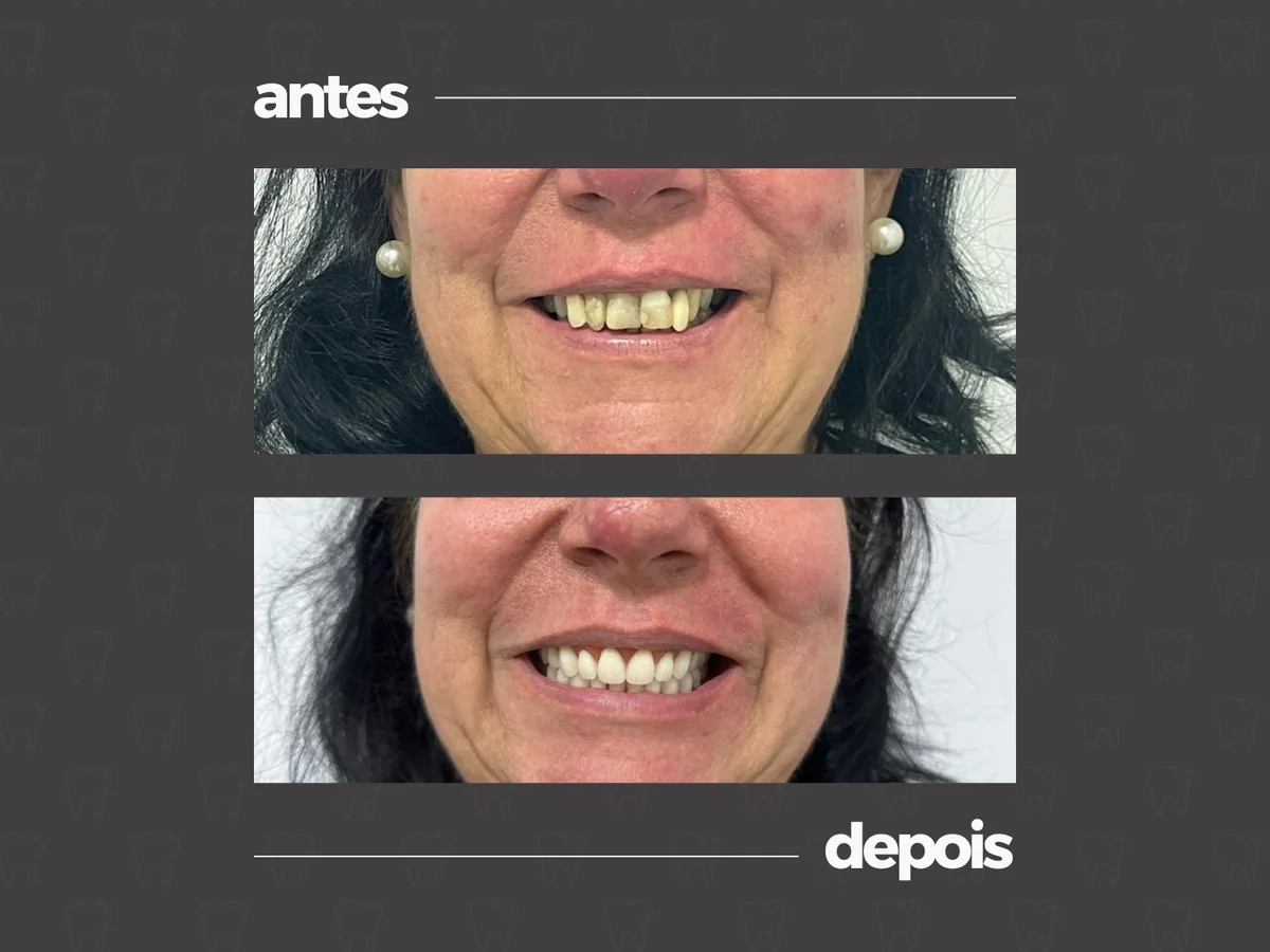Comparativo clínico antes e depois, caso 1