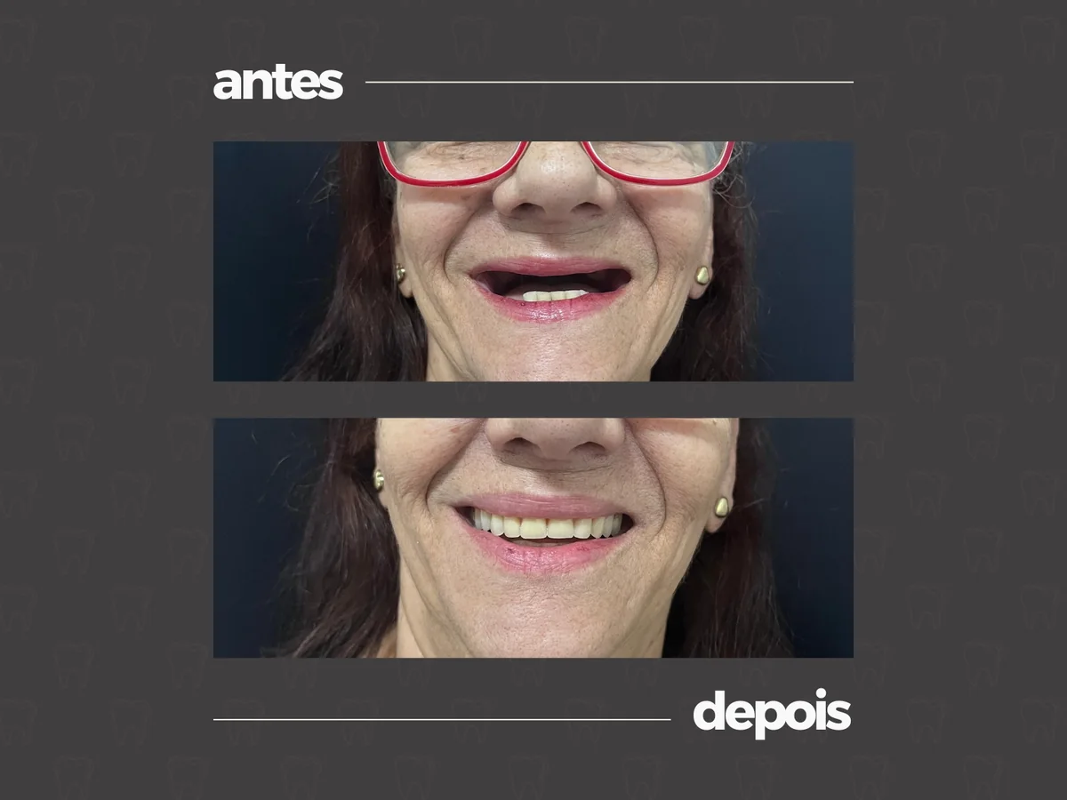 Comparativo clínico antes e depois, caso 2