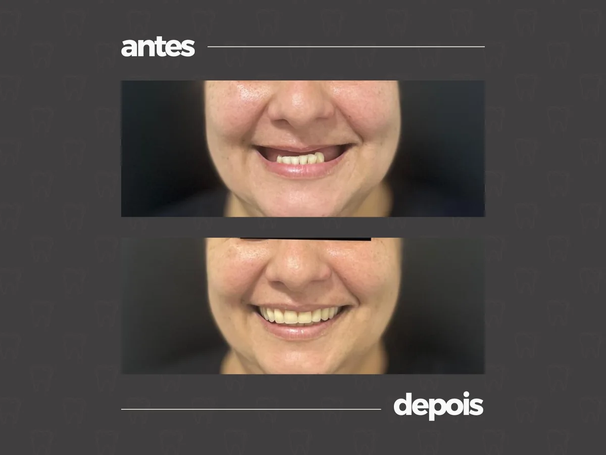 Comparativo clínico antes e depois, caso 5