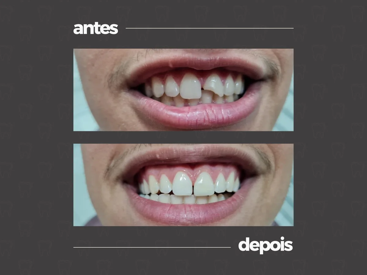 Comparativo clínico antes e depois, caso 6
