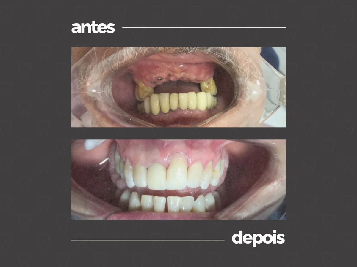 Comparativo clínico antes e depois, caso 7